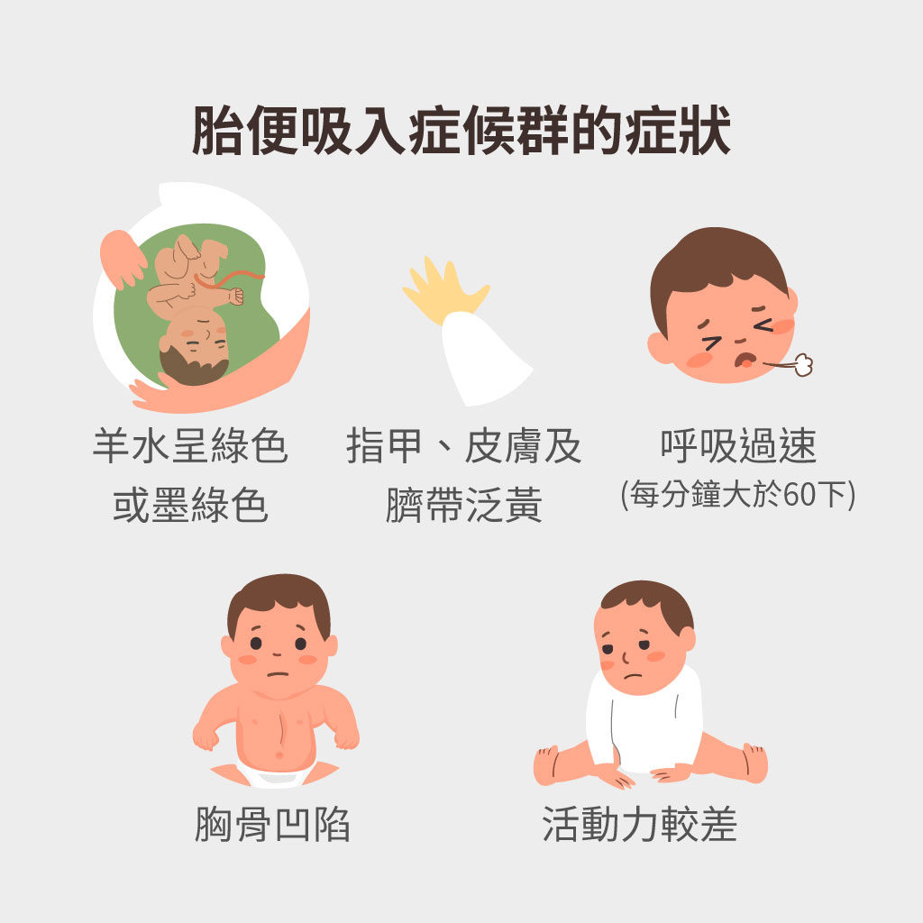 胎便知多少?胎便吸入症候群成因、症狀、風險、治療一次瞭 - mamaway