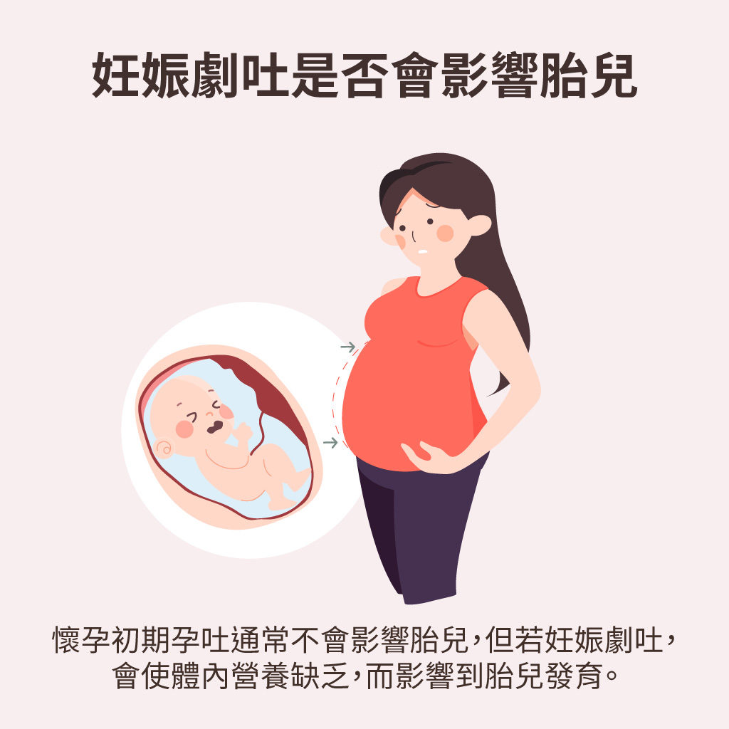 妊娠劇吐會影響胎兒嗎?