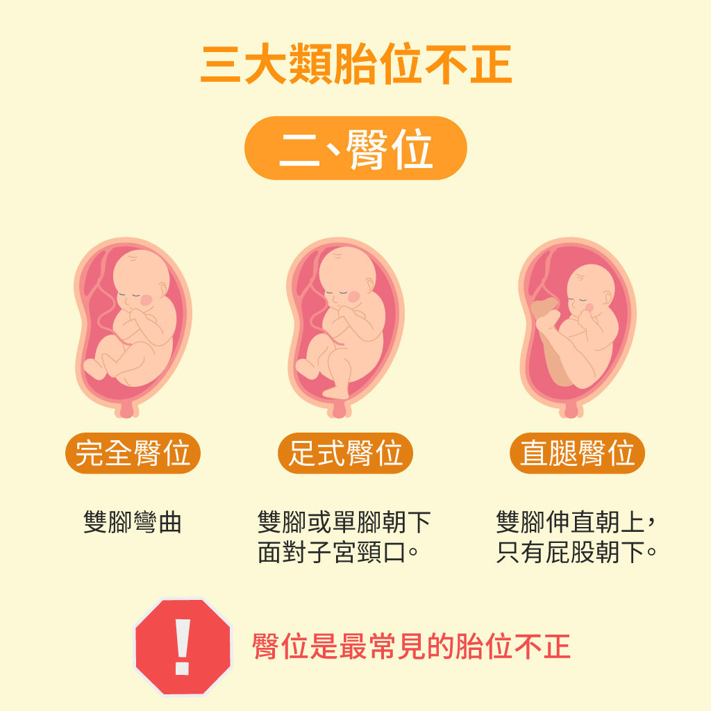 多半孕妈面临胎位不正，孕28周是临界点，孕妈要学会胎位“自纠” |孕期知识|糖糕妈妈育儿网