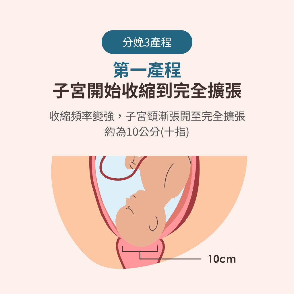 產科醫師詳解生產過程，孕媽日常可以如何為生產做準備? - mamaway