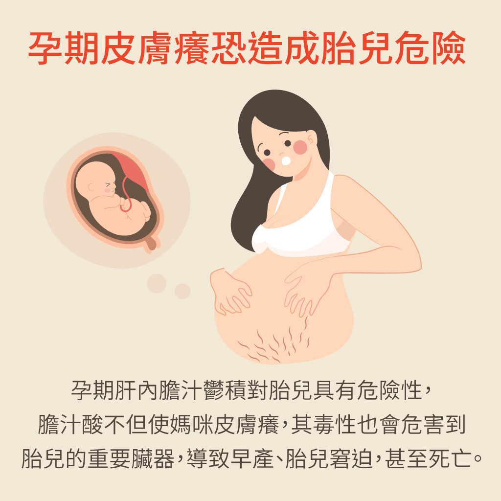 懷孕皮膚癢恐造成胎兒危險