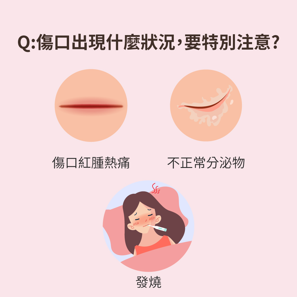 剖腹傷口出現哪些症狀不正常?