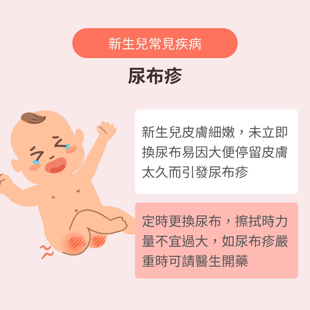 尿布疹如何护理和预防？ - 知乎