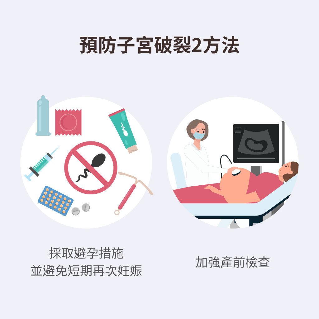 預防子宮破裂的方法