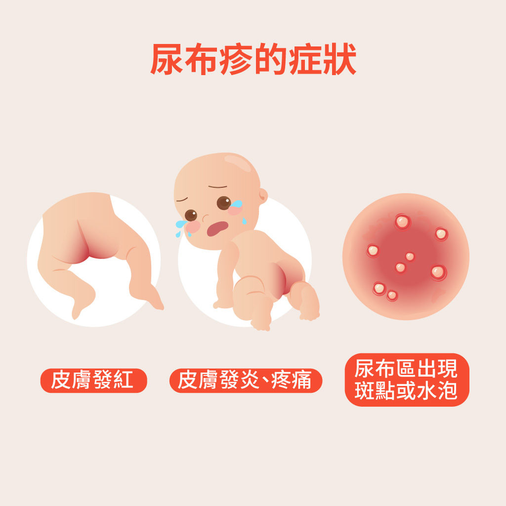 婴儿幼儿急疹症状图片_有来医生