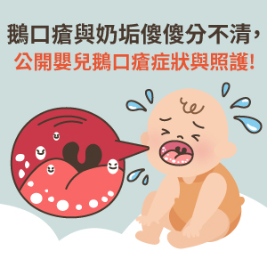 鵝口瘡與奶垢傻傻分不清?公開嬰兒鵝口瘡症狀與照護