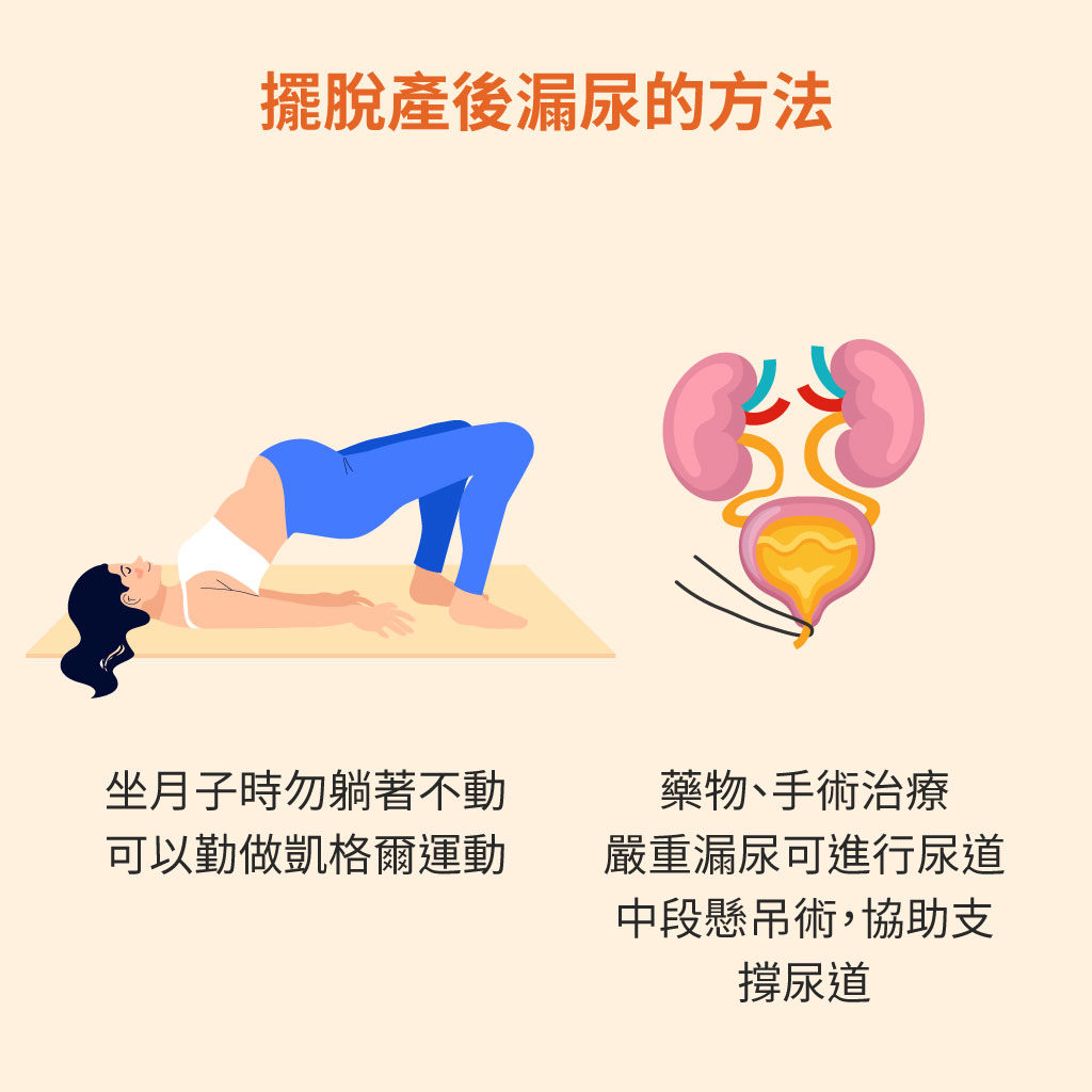 擺脫產後漏尿的方法