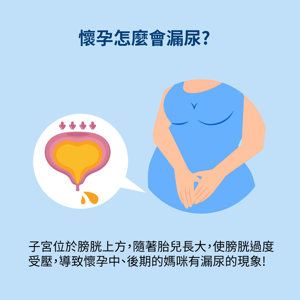 懷孕為什麼會漏尿?