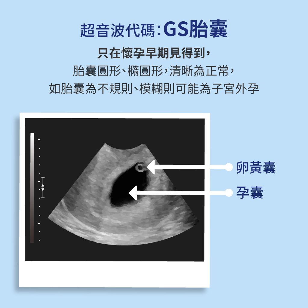 孕媽不再霧煞煞 讓您快速看懂產檢超音波照的英文代碼 Mamaway