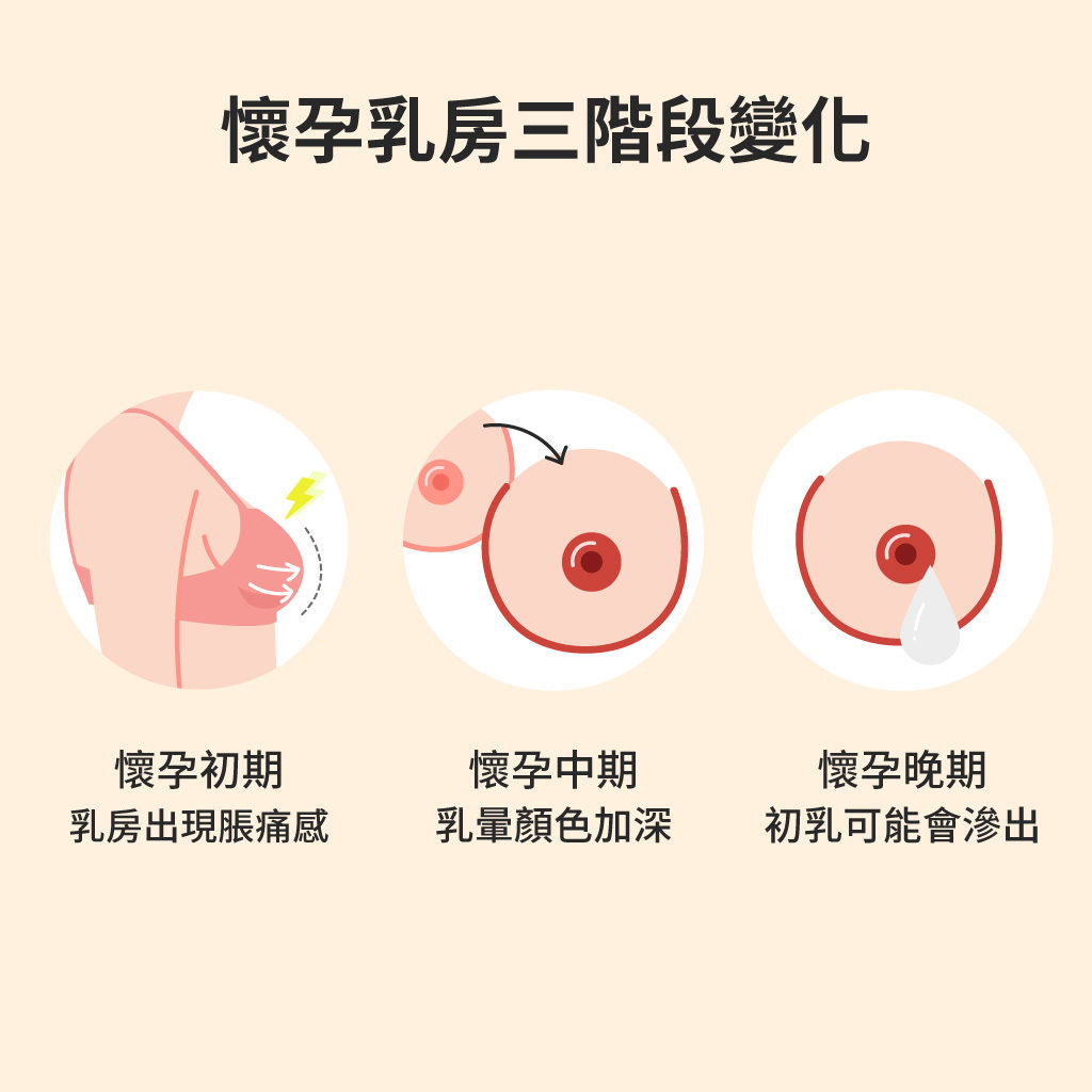 孕期三階段乳房變化