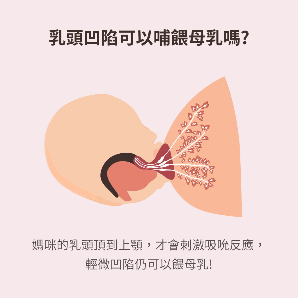 52+ 图片 乳頭 新的 30 乳頭凹陷沒有奶頭怎麼辦?學會3招依然可以順利哺乳! - mamaway