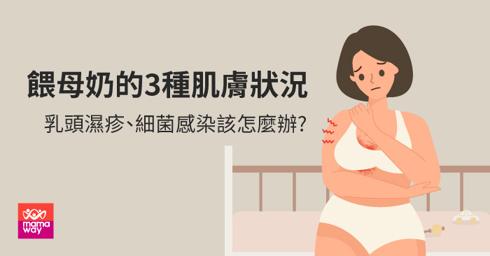 餵母奶的3種肌膚狀況，乳頭濕疹、細菌感染該怎麼辦?
