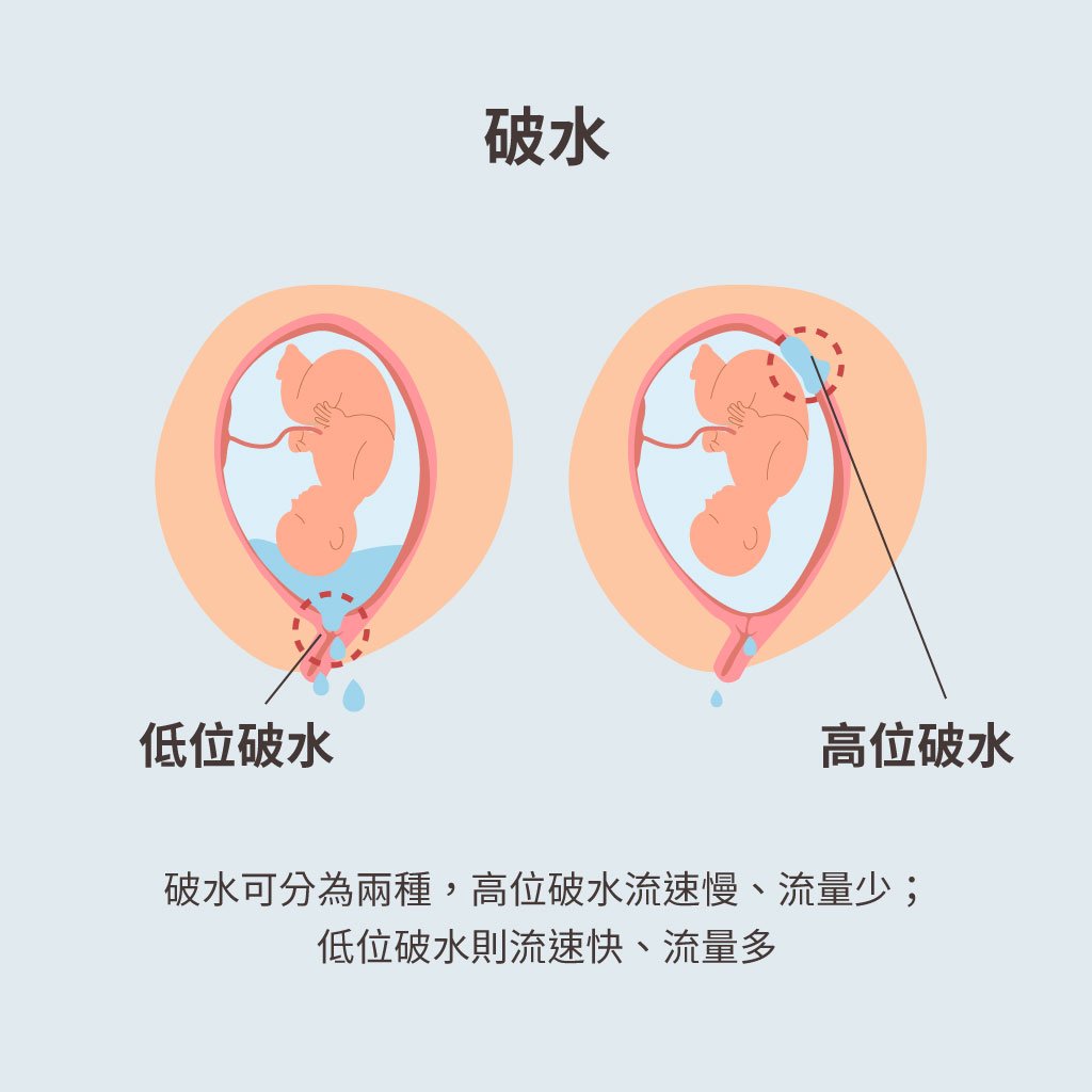 破水 