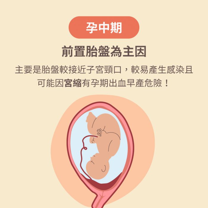 懷孕出血 麥驚 認識孕期三階段 各種懷孕出血之原因 Mamaway