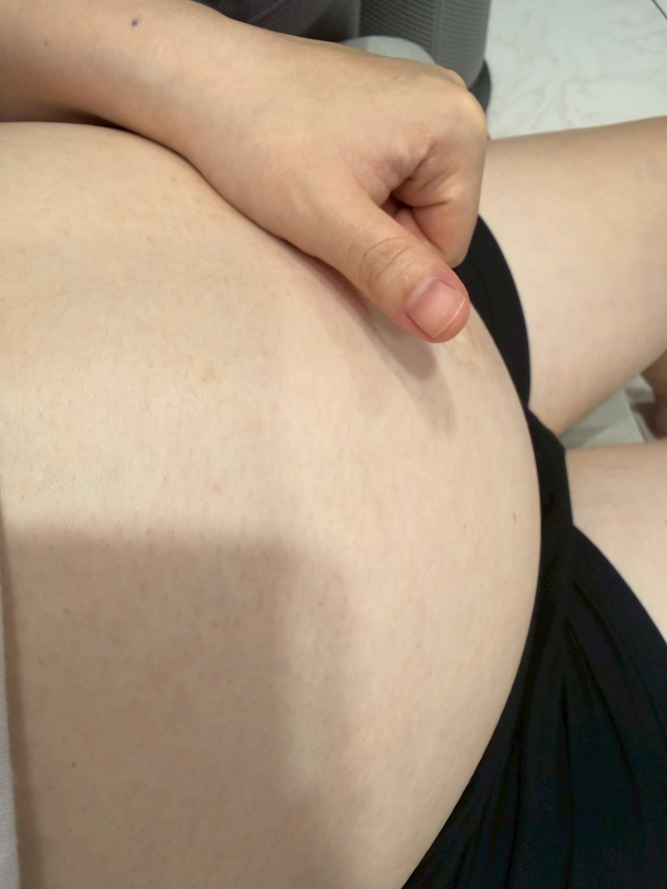 2 2